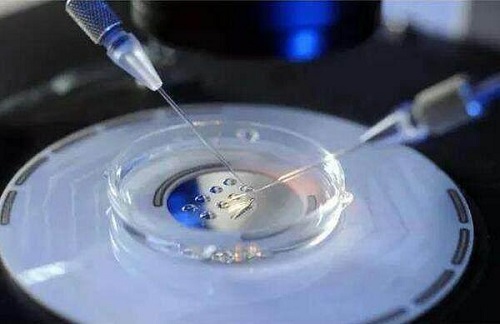 试管婴儿分别有哪几种？