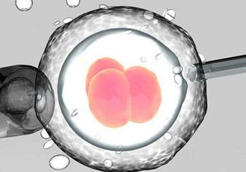 试管婴儿=1个精子+1个卵子，这么简单？泰国试管婴儿流程